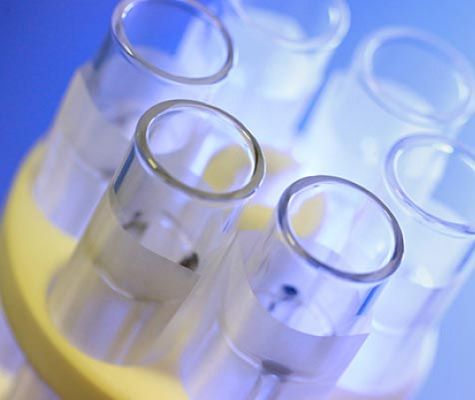 [Translate to 中国人:] Manual fibre analysis with FibreBag units from Gerhardt Analytical Systems